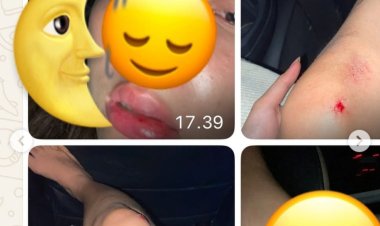 DPC AMIRA Pandeglang, Akan Lakukan Aksi Unras, Terkait Oknum Anggota DPRD Pandeglang Yang Aniaya Mantan Pacar