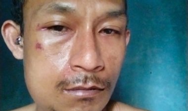 Dituduh Mencuri Yuanta, Dipukuli Oknum Kades  Warung Banten Dan Rekan-Rekannya.