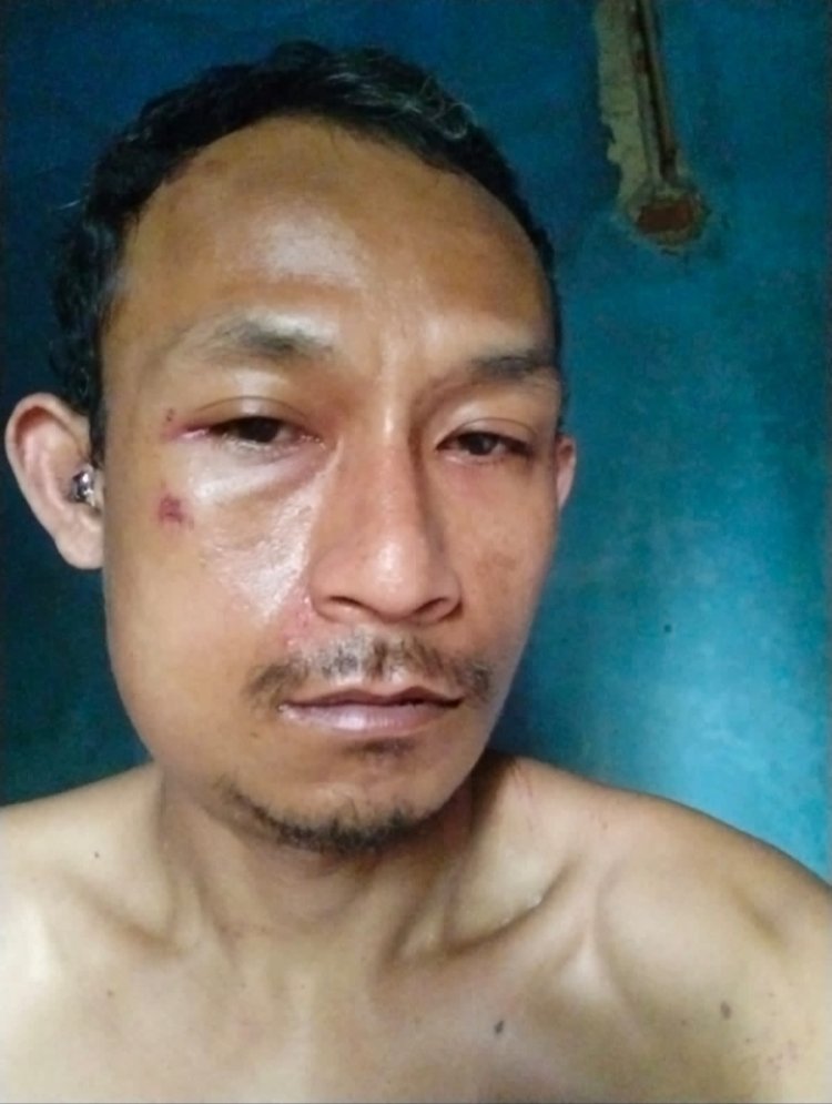 Dituduh Mencuri Yuanta, Dipukuli Oknum Kades  Warung Banten Dan Rekan-Rekannya.