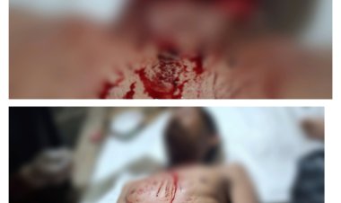 Ojek Pangkalan Tarogong Dibegal Penumpang, Leher Digorok !! 