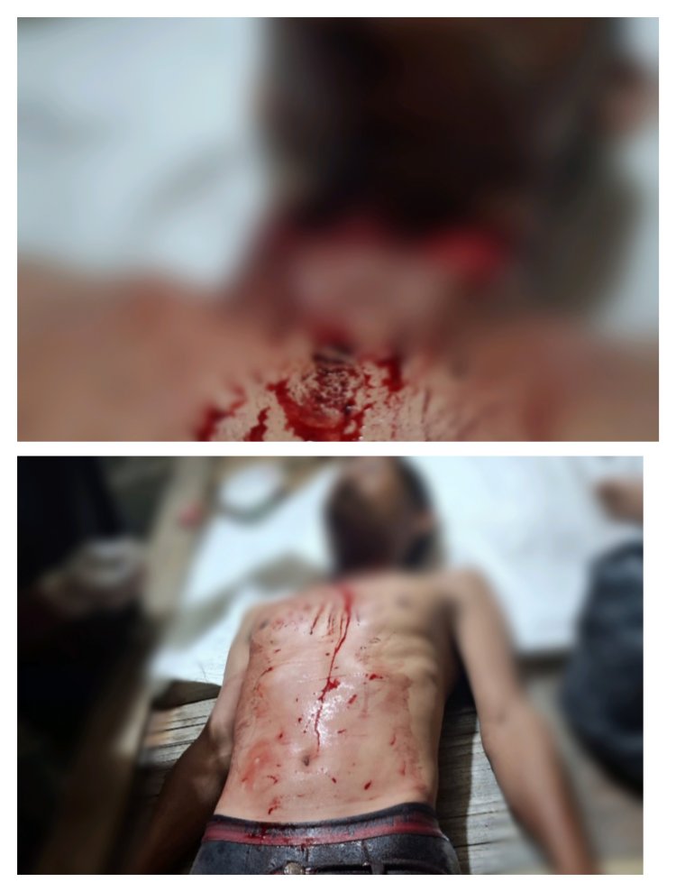 Ojek Pangkalan Tarogong Dibegal Penumpang, Leher Digorok !! 