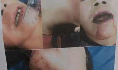 Miriiis..!! Kasus Korban Penganiyan Mariyam Warga Cilaban Bulan, Belum Ada Kepastian Hukum