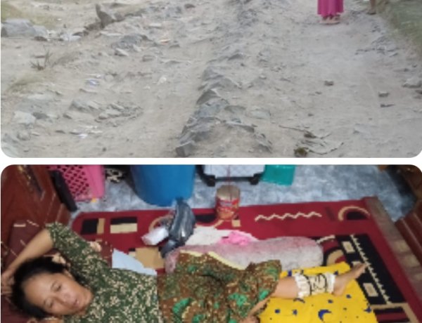 Jalan Menuju Kampung Cigebang Rusak Parah, Seorang Pengendara Alami Patah Tulang  ‎