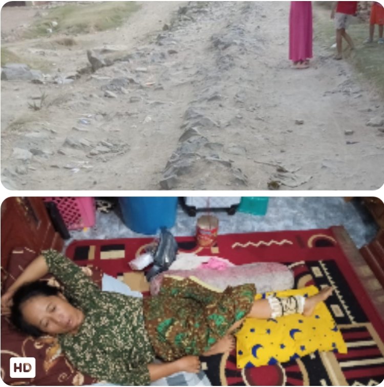 Jalan Menuju Kampung Cigebang Rusak Parah, Seorang Pengendara Alami Patah Tulang  ‎